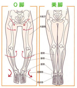 O脚の構造イメージ
